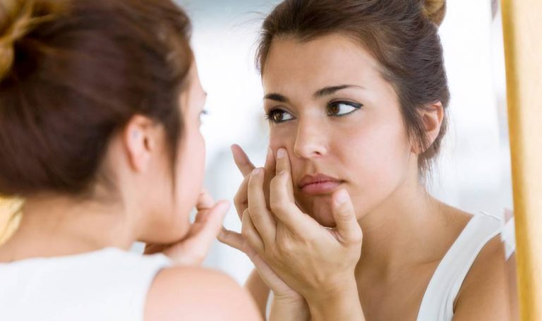 Estos son los hábitos que generan acné sin que te des cuenta