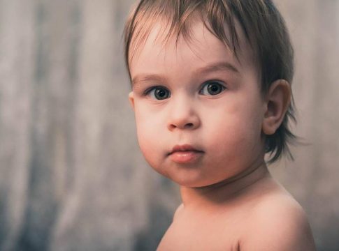 Qué es el falso estrabismo 1 Qué es el falso estrabismo