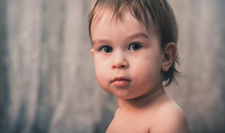 Qué es el falso estrabismo