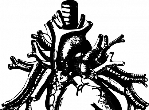 Qué es la miocarditis y cómo tratarla 3 Qué es la miocarditis y cómo tratarla