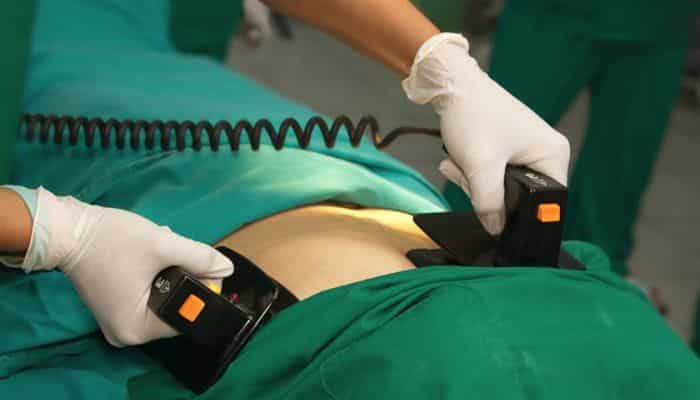 Qué es un desfibrilador 313 ¿En qué casos está indicado el uso del desfibrilador?