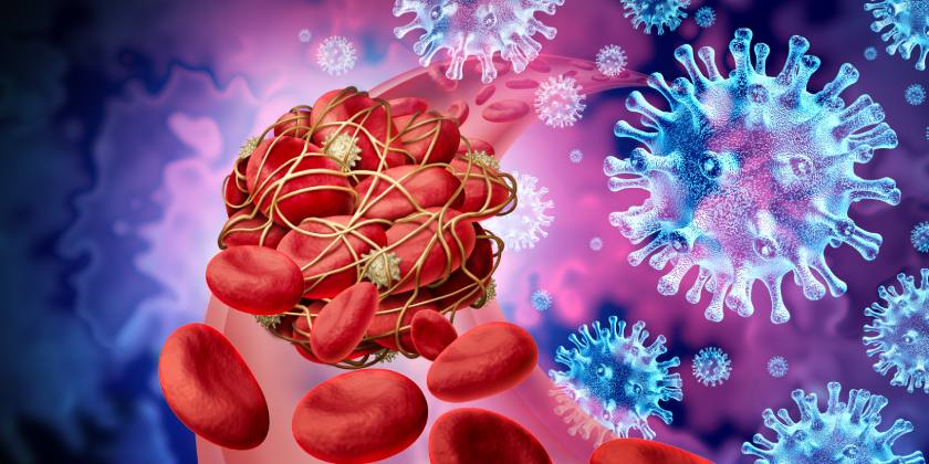 Qué es una embolia 6 ¿Cuáles son las secuelas de una embolia?