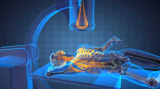 Qué es una gammagrafía 63 ¿Se corren riesgos cuando nos realizamos una gammagrafía?