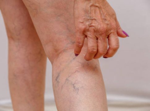 Elección de ropa cómoda Elección de ropa cómoda