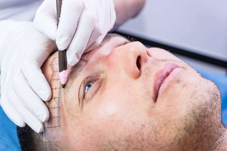 El trasplante capilar en las cejas, por Clínicas Dr. Pelo