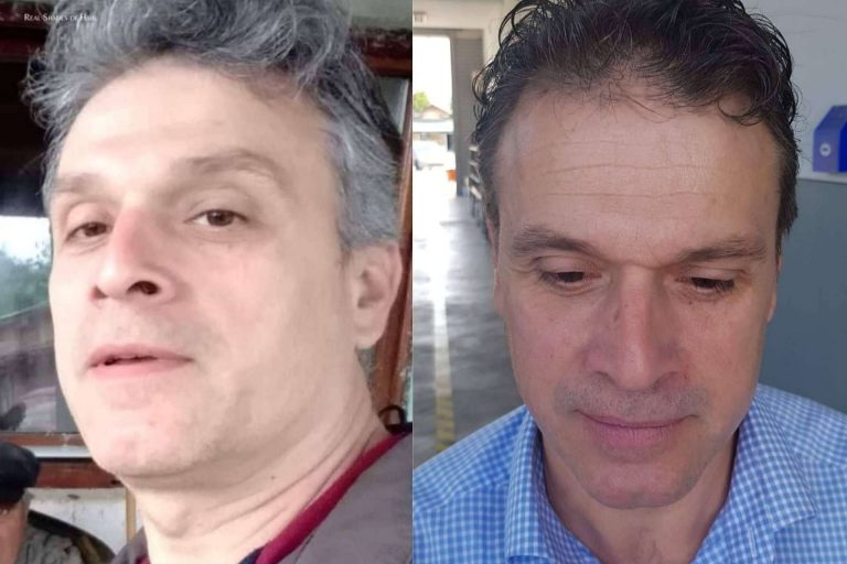 la sinergia de 4 componentes naturales para acabar con las canas