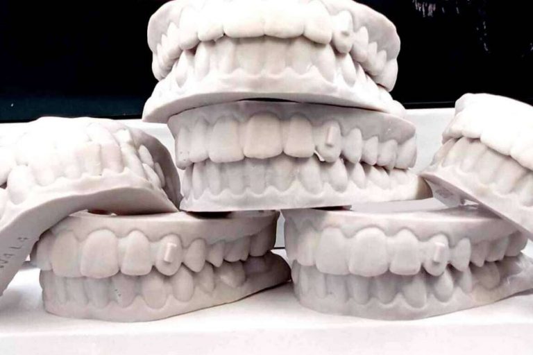 ¿Qué es la ortodoncia invisible?: Clínicas Hernadent