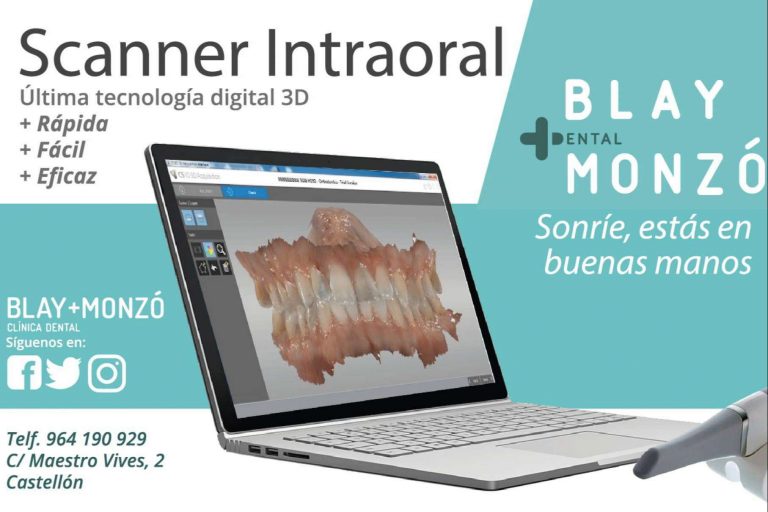 las técnicas avanzadas en implantología