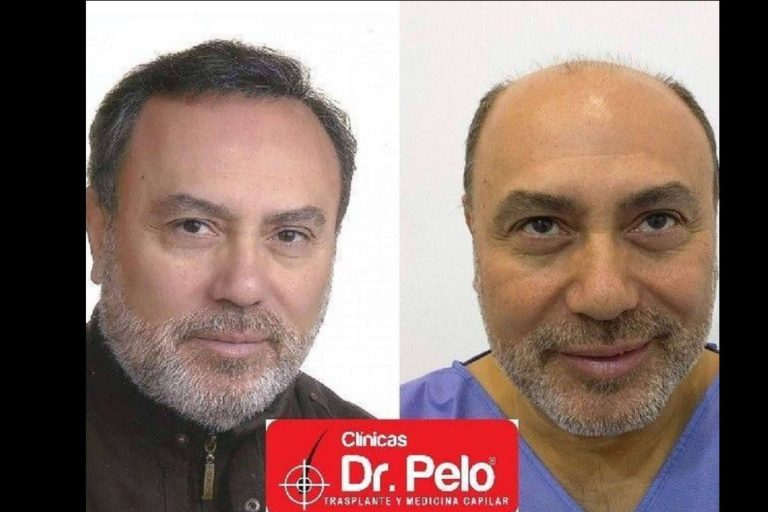 Tratamientos capilares de todo tipo en las Clínicas Dr. Pelo