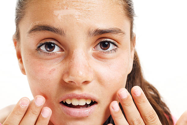 ¿Cuáles son los tipos de manchas que puede tener el ser humano?