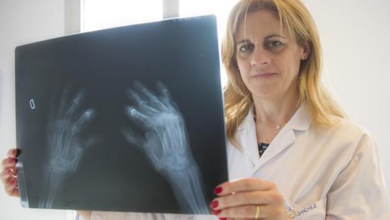 Así pueden destrozar tu cuerpo las radiografías