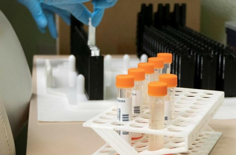 Castilla-La Mancha registra 79 positivos nuevos, 18 en UCI y un fallecido