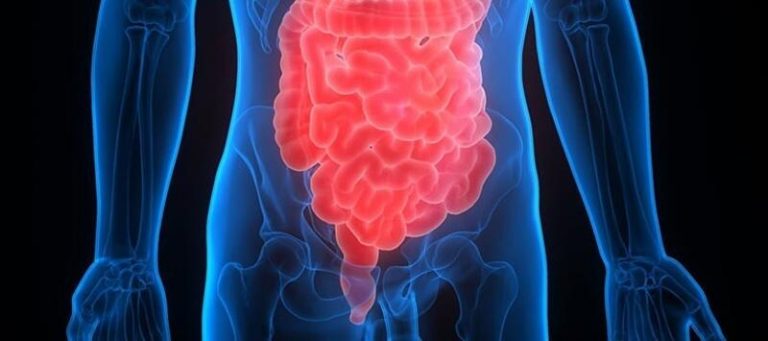 Defectos genéticos llevan a diagnósticos erróneos de síndrome de intestino irritable