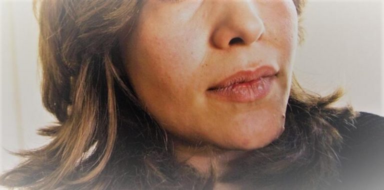 Cáritas reclama medidas 