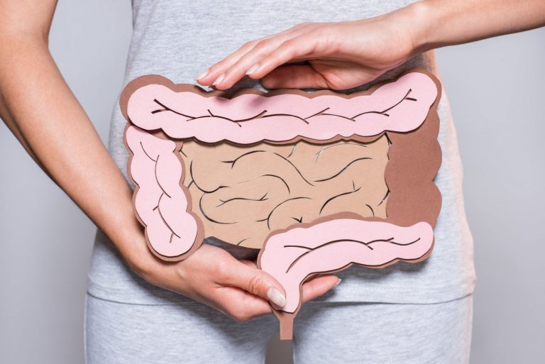 Cáncer de colon: las formas de prevenirlo