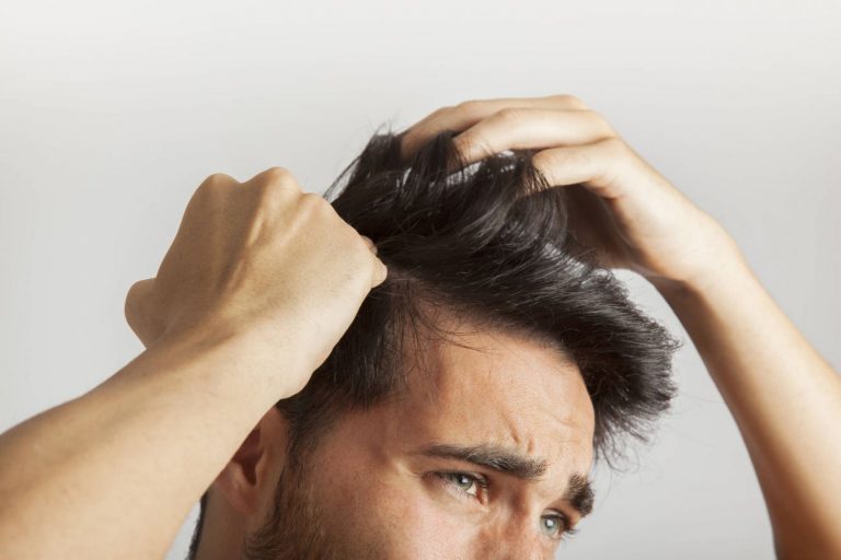 El curioso método para acabar con la caída del pelo