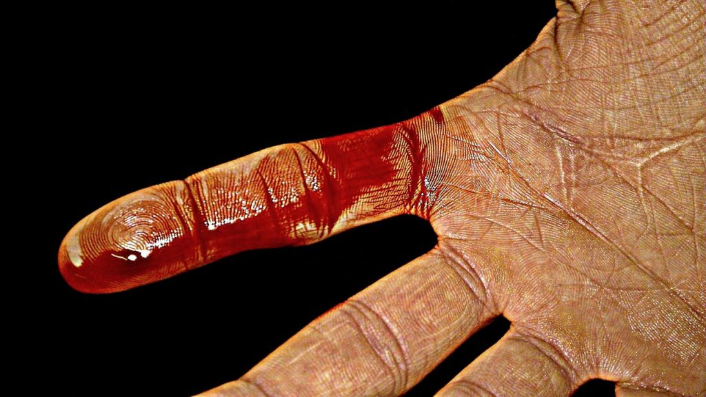 ¿Qué es la necrosis?