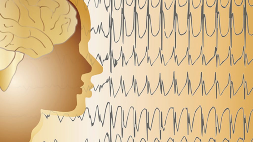 ¿Cuáles son los tipos de epilepsia?
