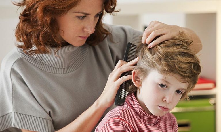 Cómo acabar con los piojos de forma natural