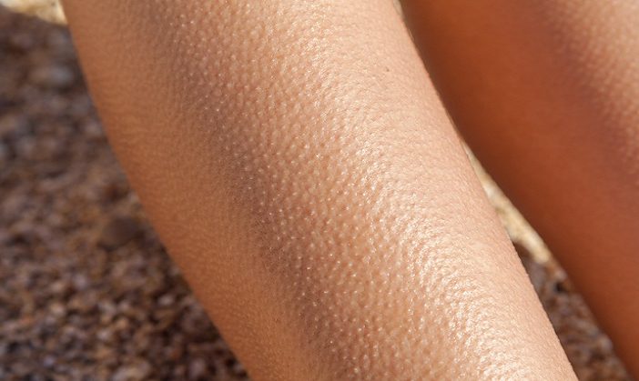 Te explicamos por qué se te pone la piel de gallina