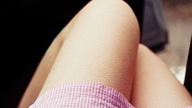 Te explicamos por qué se te pone la piel de gallina