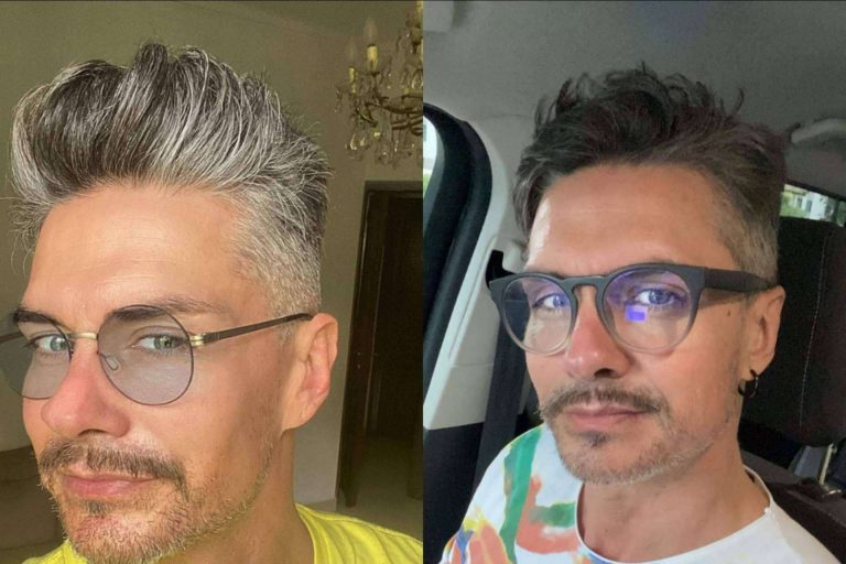 GR-7 Professional recupera el color natural del cabello, ¿Qué color elegir para las canas?