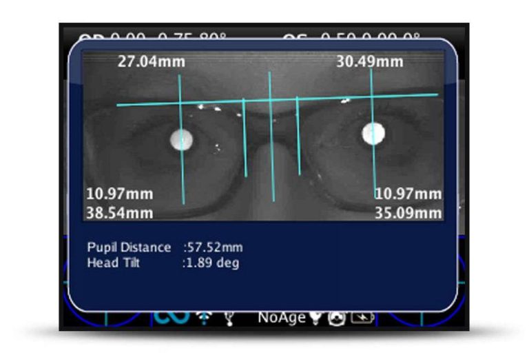 una de las formas más rápidas de detectar problemas de visión es 2WIN