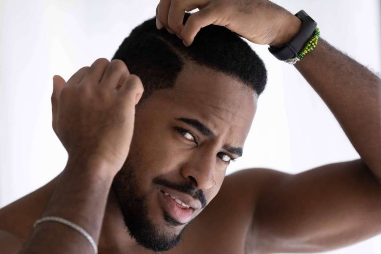 La clínica Élite Capilar permite realizarse un injerto capilar sin cicatriz en Alicante