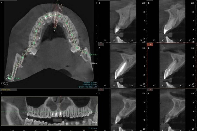 El innovador CBCT dental 3D disponible en la Clínica Blay+Monzó