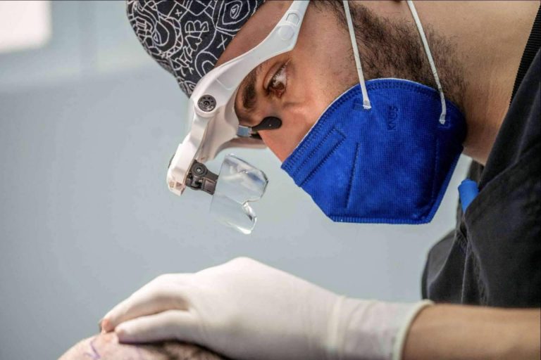 Todo lo que hay que saber sobre la cirugía capilar y la zona donante, por el Doctor Bern