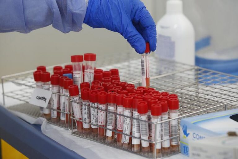 Baleares notifica 102 casos desde el martes