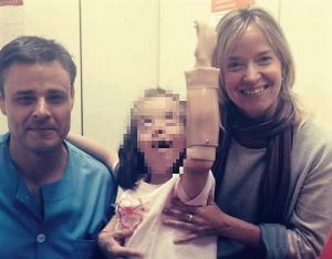 El caso de una niña con Síndrome de Down y una prótesis mioeléctrica llega al Congreso de Educación Especial