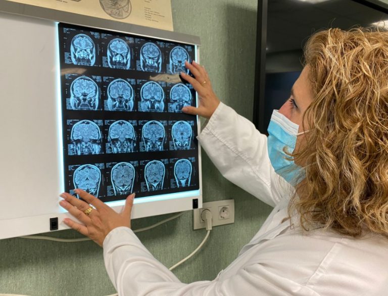 La arriesgada cirugía para curar la migraña se expande como una epidemia