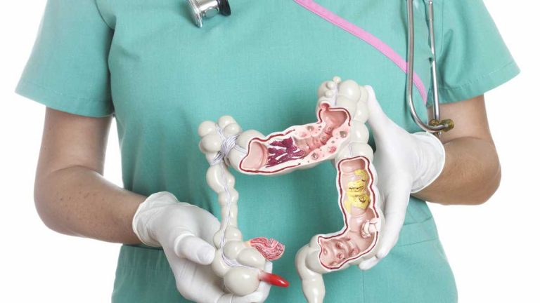 Los motivos por los que estás estreñido