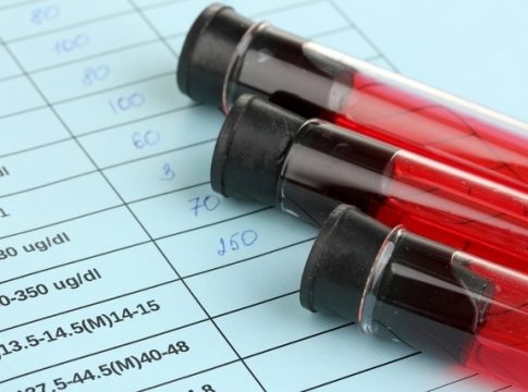 Qué es el hematocrito 1 Qué es el hematocrito