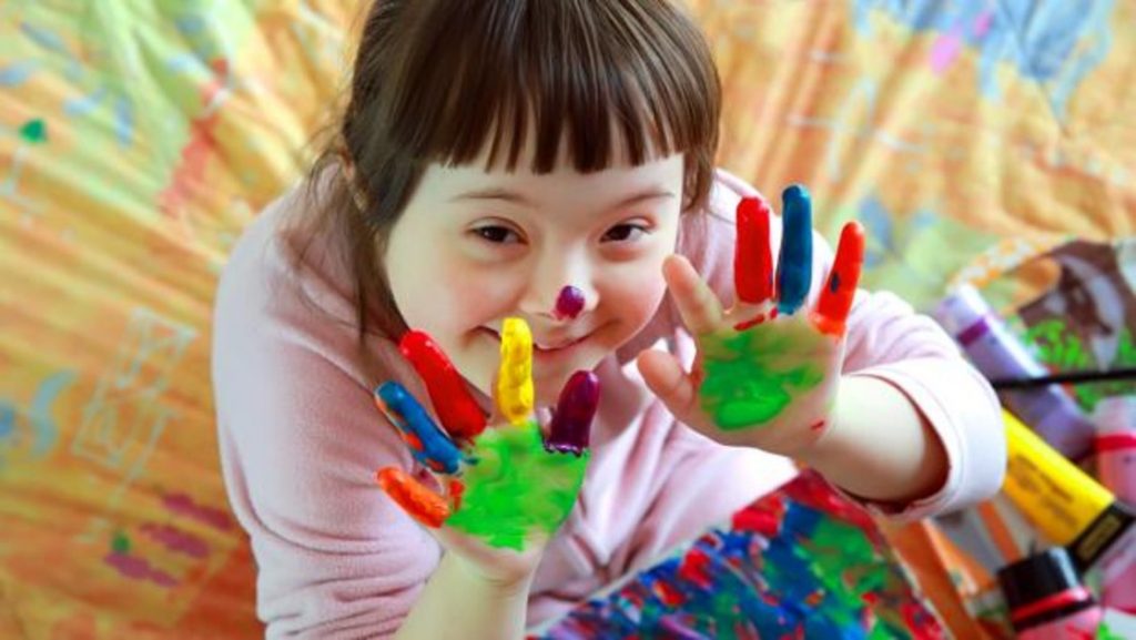 Qué es el síndrome de down 1 ¿Qué es el síndrome de down?