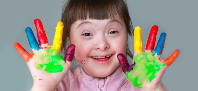 Qué es el síndrome de down 2 ¿Cuál es la expectativa de vida de una persona con síndrome de down?