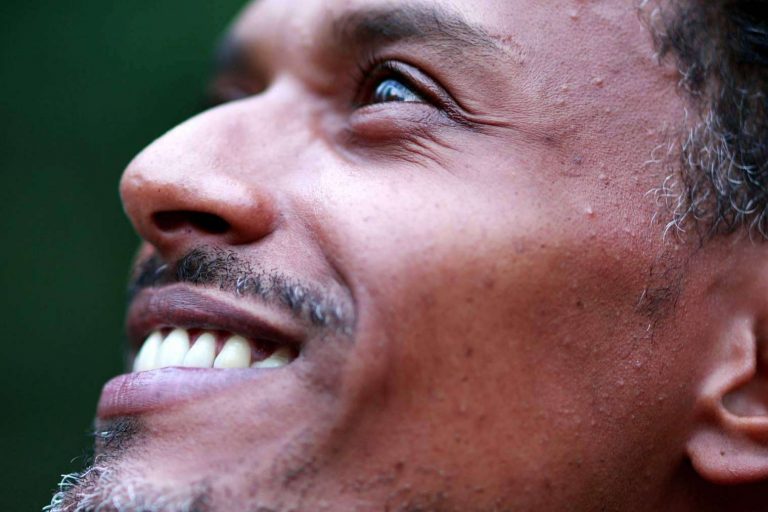 ¿Cómo abordar la salud mental de las personas con diversidad funcional? DFR