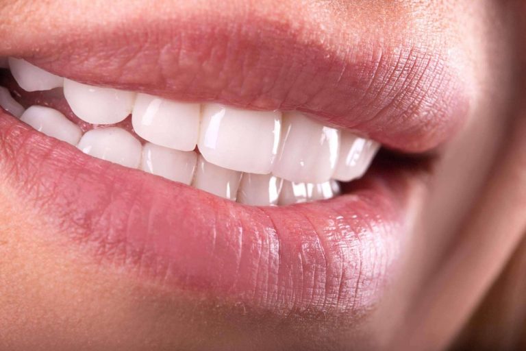 La Clínica Sonrisas de Corrales Dental garantiza implantes dentales de calidad mediante un tratamiento de calidad