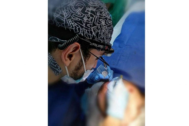 Dedicación, clave del éxito de los tratamientos con el método DHI para retrasar el efecto de la calvicie