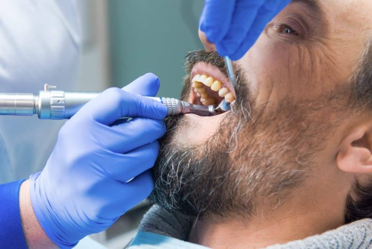 Helident Clínica Dental realiza limpiezas dentales profesionales