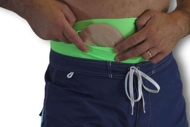 Maldita Hernia, las fajas para bañarse en la piscina con una ostomía