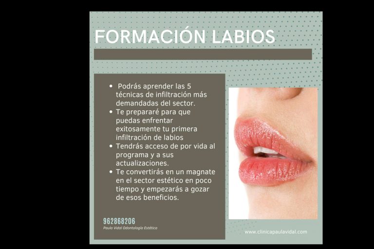 Curso para odontólogos de relleno de ácido hialurónico, por Clínica Paula Vidal