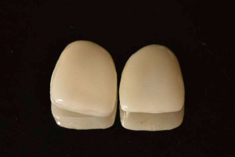 Las ventajas de los tratamientos de estética dental según Implant Clinics