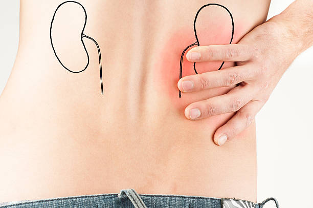 Toma nota de lo que significa padecer un dolor de riñón