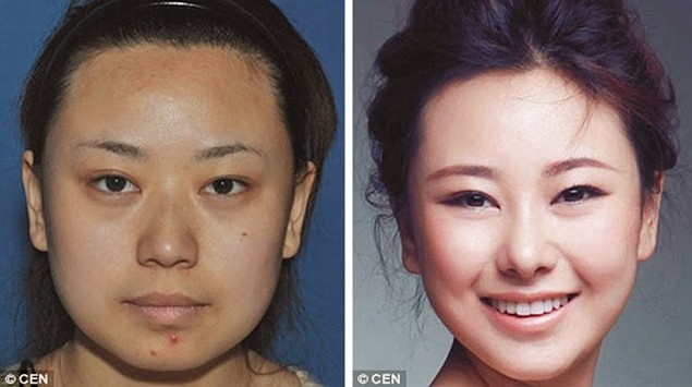 12 casos de cirugía plástica extrema 1 12 casos de cirugía plástica extrema