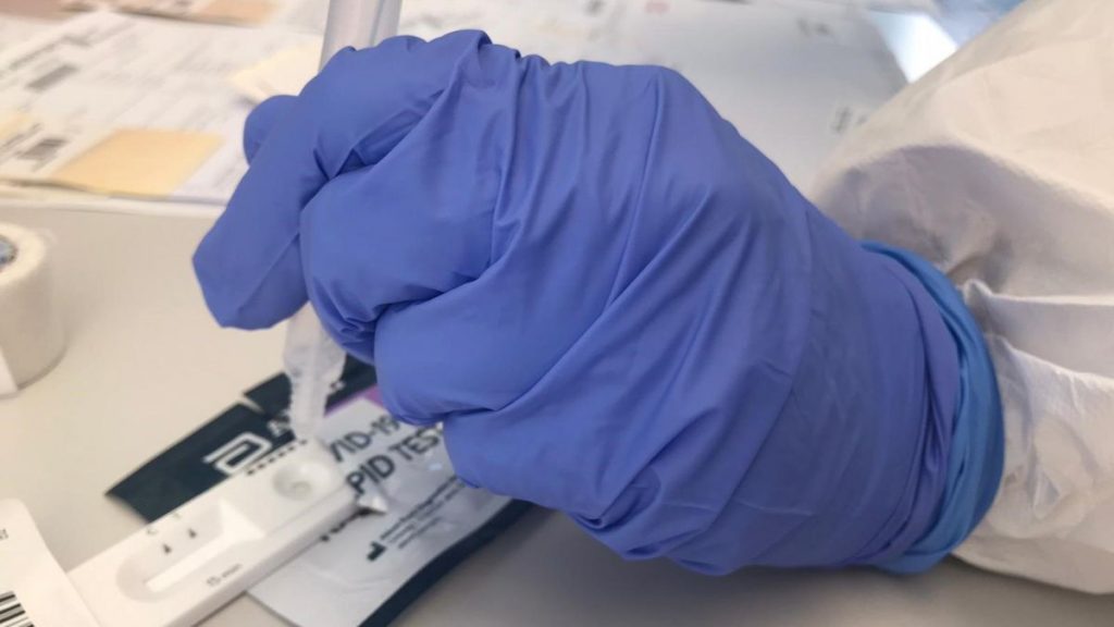 ¿Qué facilita el test de antígenos?