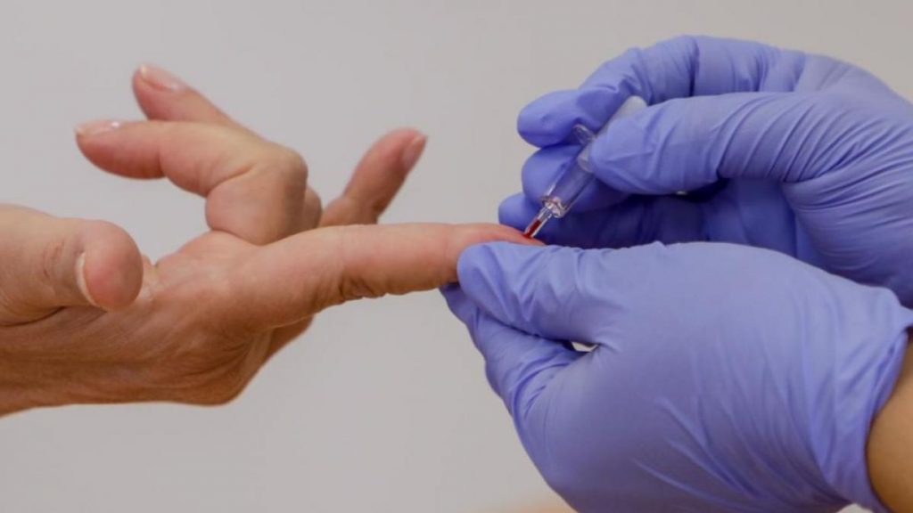 ¿Cómo funciona el test de antígenos?