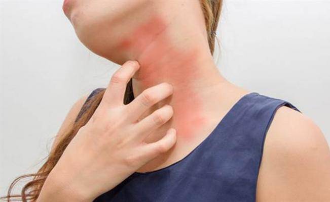 Cómo saber si eres alérgico a la lana y qué hacer