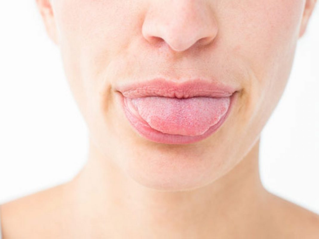 Esto es lo que dice tu lengua de tu salud